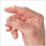 3PP OVAL-8 Finger Splints Graduated Sets (3 Pack). Fixed Price $26.99.